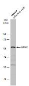 Anti-VAV2 antibody used in Western Blot (WB). GTX131451